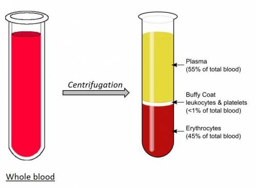 Plasma is the  fibers in blood matrix of blood cell that phagocytizes bacteria cell fragment found i