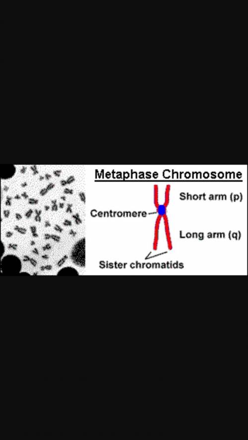 Draw what a chromosome looks like during metaphase. identify the chromatids and the centromere