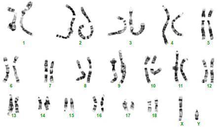The karyotype on the first slide shows a male or female?