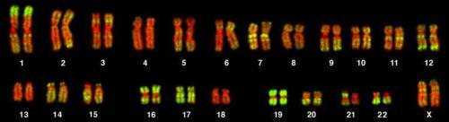 The karyotype on the first slide shows a male or female?