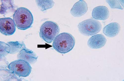 What stage are these cells in?  select one:  a. anaphase b. metaphase