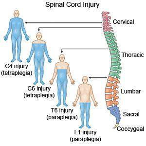 Sometimes the spinal cord can be damaged in an accident. depending on the location and severity of t