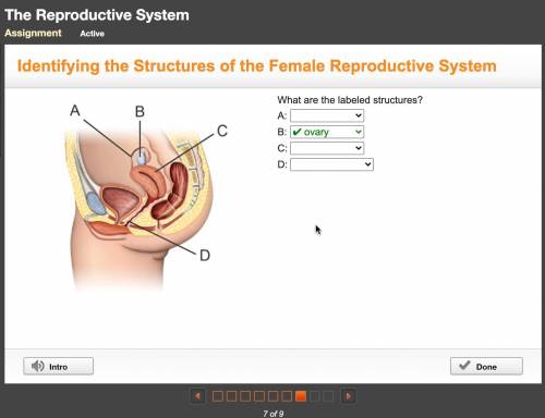 Please help! What are the labelled structures of the female reproductive system?

Options:•Uterus