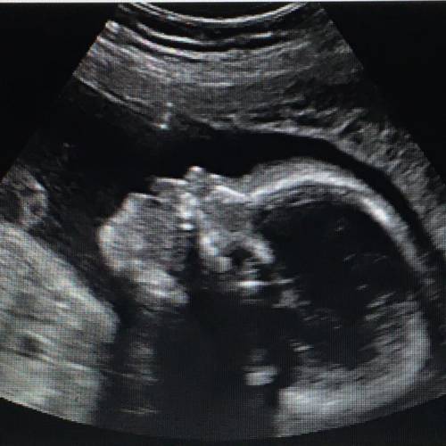 This image of a baby was produced using ultrasound.

Which option is the best model of how the ima
