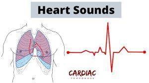 Which of the following events occur at the start of diastolic production of first heart sounds S1
