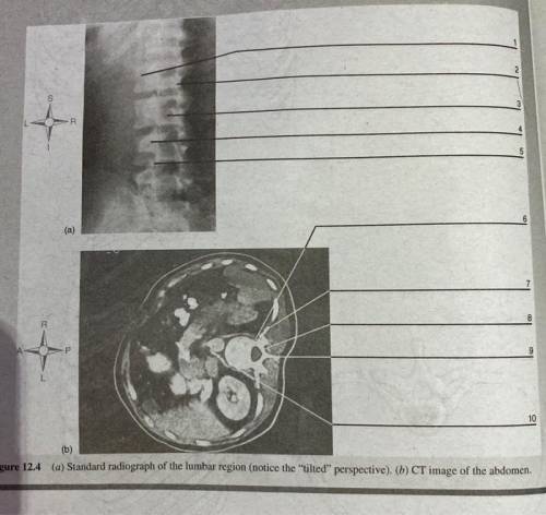 Standard radiograph of the lumbar region titled perspective
c t scan of abdomen