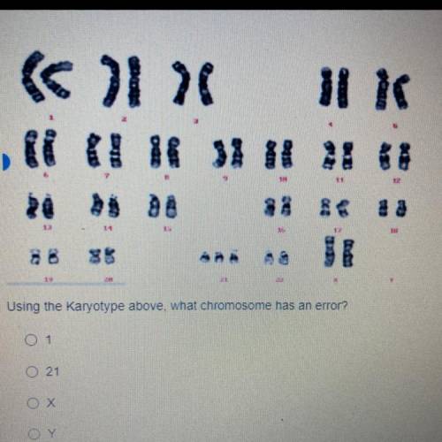 Using the Karyotype above, what chromosome has an error?
1
21
X
Y