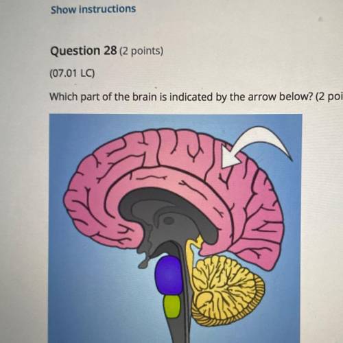 Which part of the brain is indicated by the arrow below? (2 points)