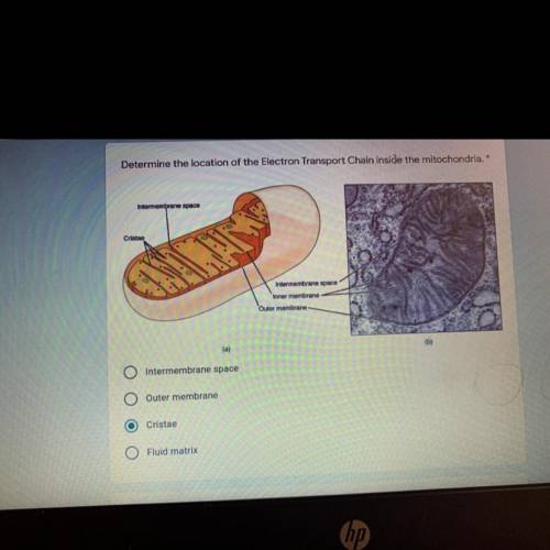 Determine the location of the electron transport chain inside the mitochondria

DONT POST ANY LINK