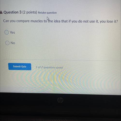 A Question 3 (2 points) Retake question

Can you compare muscles to the idea that if you do not us